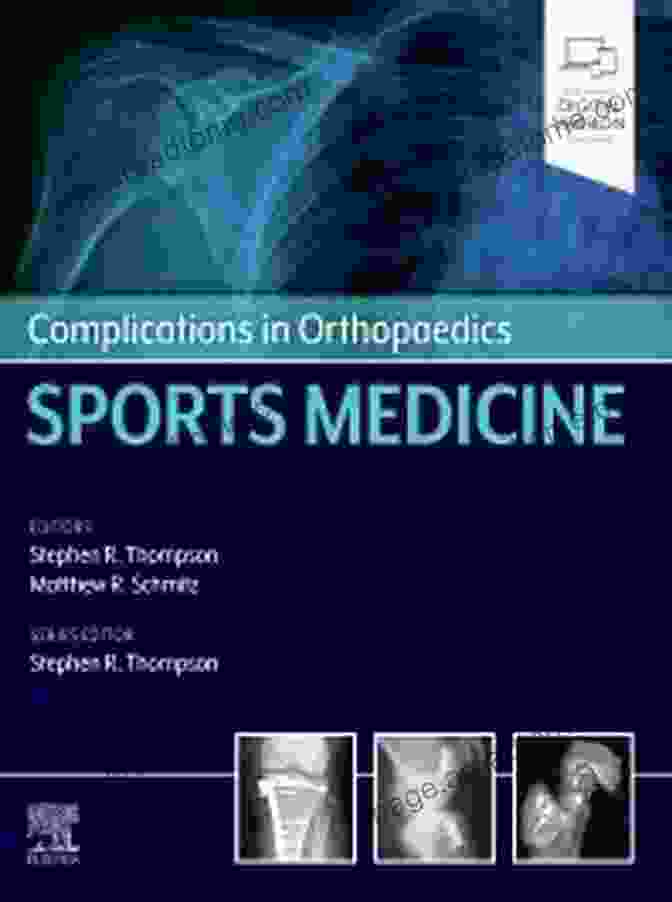 Complications In Orthopaedics Sports Medicine Book Cover Complications In Orthopaedics: Sports Medicine