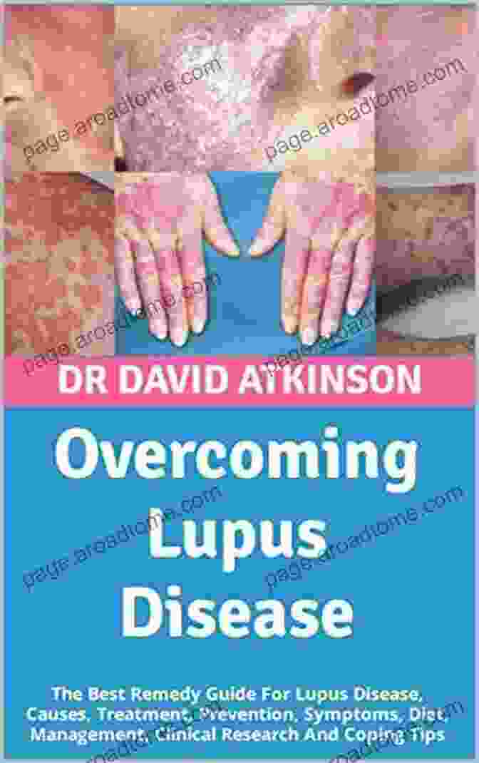 Improving Lupus In 30 Days: The Definitive Guide To Managing And Overcoming Lupus Symptoms Improving Lupus In 30 Days Robert Redfern