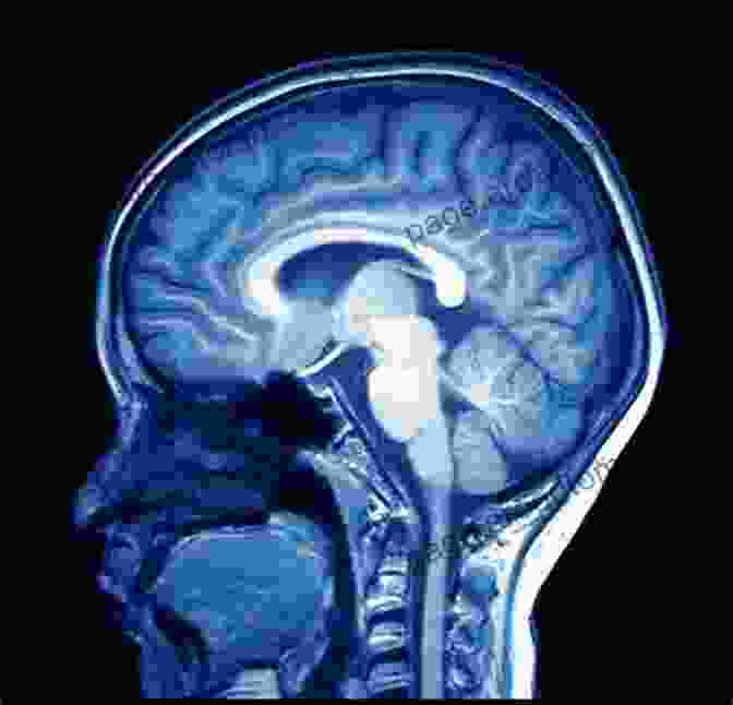 MRI Scan Of The Human Brain Highlighting The Island Of Reil (Insula) Island Of Reil (Insula) In The Human Brain: Anatomical Functional Clinical And Surgical Aspects