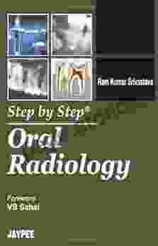 Step by Step Oral Radiology