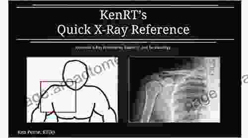 KenRT S Quick X Ray Reference: Common X Ray Procedures Anatomy And Terminology